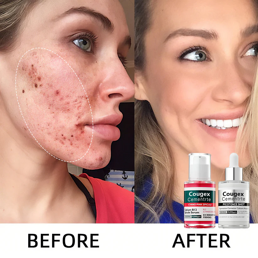 đ„Shrinks Pores & Fades Blemish Marks in 2 Weeks | Cyano Pink Spicule Serum+ Picotonic Shot Ampoule