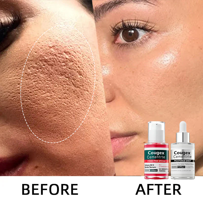 đ„Shrinks Pores & Fades Blemish Marks in 2 Weeks | Cyano Pink Spicule Serum+ Picotonic Shot Ampoule