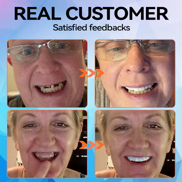 HZA™ 🗽 Silicone Reline Denture Set (⏰Limited Time 80% Off - Last 30 Minutes ⏰)