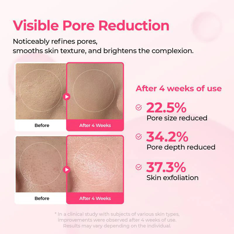 đ„Shrinks Pores & Fades Blemish Marks in 2 Weeks | Cyano Pink Spicule Serum+ Picotonic Shot Ampoule