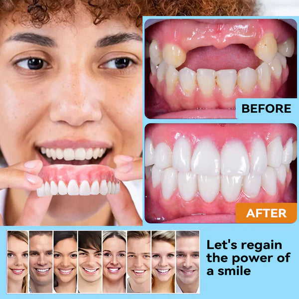 HZA™ 🗽 Silicone Reline Denture Set (⏰Limited Time 80% Off - Last 30 Minutes ⏰)