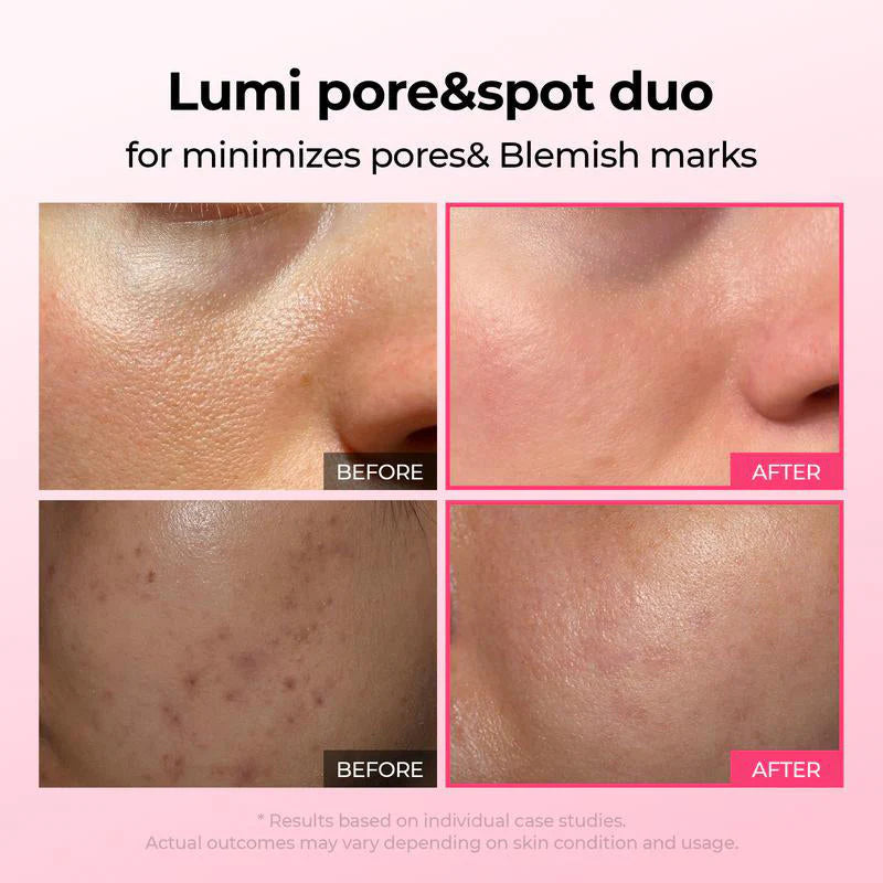 đ„Shrinks Pores & Fades Blemish Marks in 2 Weeks | Cyano Pink Spicule Serum+ Picotonic Shot Ampoule