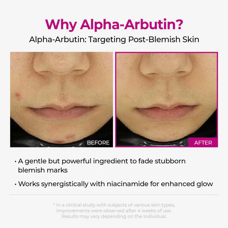 đ„Shrinks Pores & Fades Blemish Marks in 2 Weeks | Cyano Pink Spicule Serum+ Picotonic Shot Ampoule