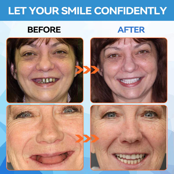 HZA™ 🗽 Silicone Reline Denture Set (⏰Limited Time 80% Off - Last 30 Minutes ⏰)