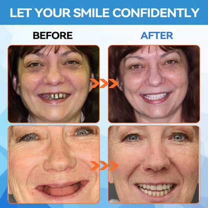 HZA™ 🗽 Silicone Reline Denture Set (⏰Limited Time 80% Off - Last 30 Minutes ⏰)