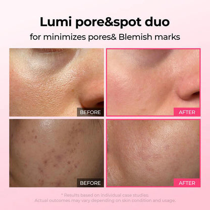 💥Shrinks Pores & Fades Blemish Marks in 2 Weeks | Cyano Pink Spicule Serum+ Picotonic Shot Ampoule